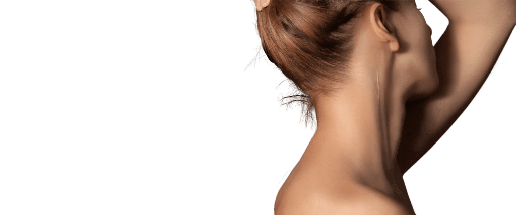 Radiofrequency Scar Reduction cosmetic treatments sydney