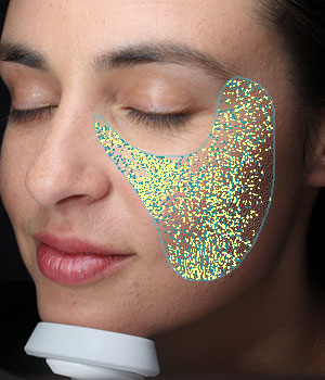 View skin texture with Visia