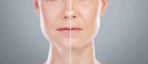 Side-by-side comparison of youthful and aging skin.